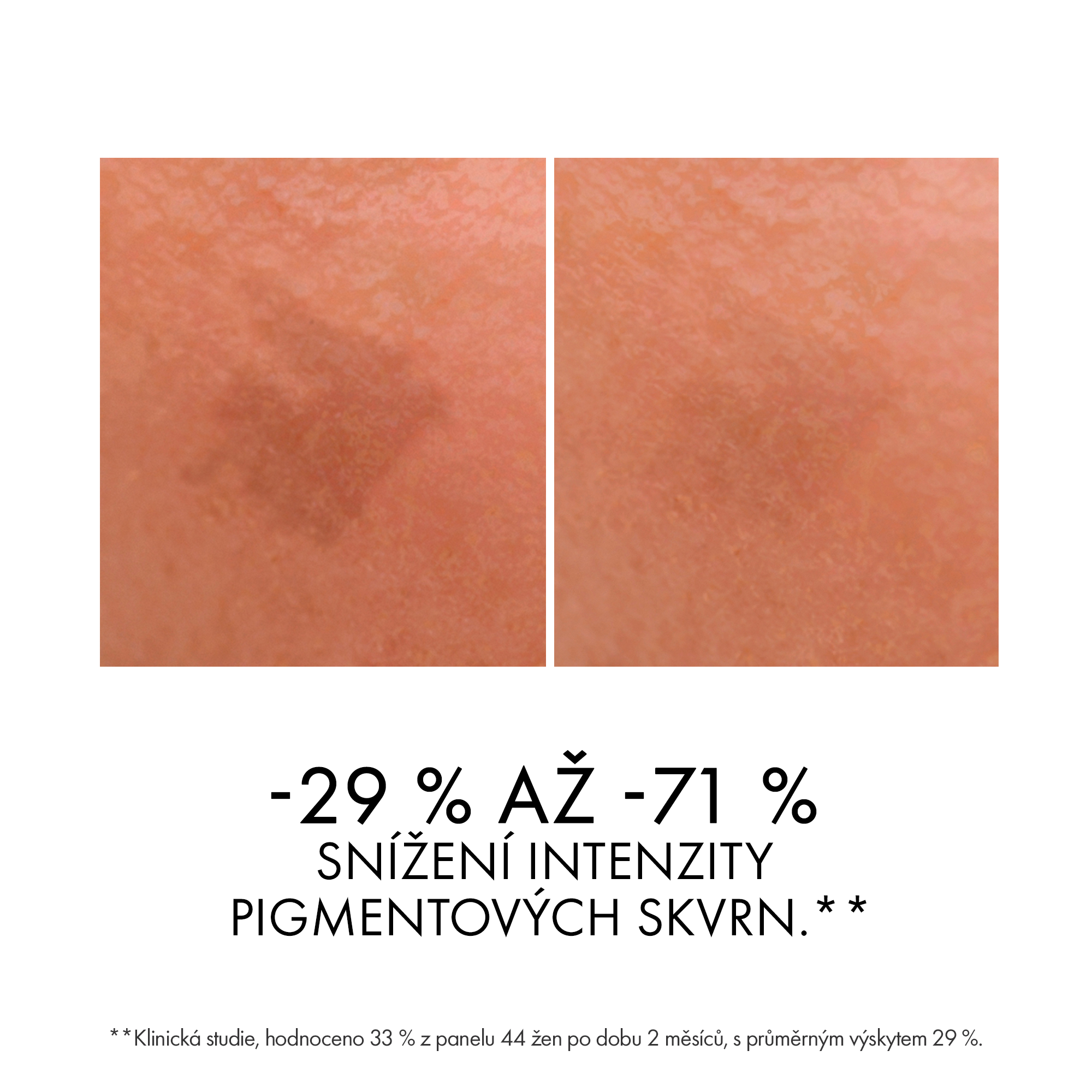VICHY Liftactiv Specialist B3 Szérum arcszérum 30 ml