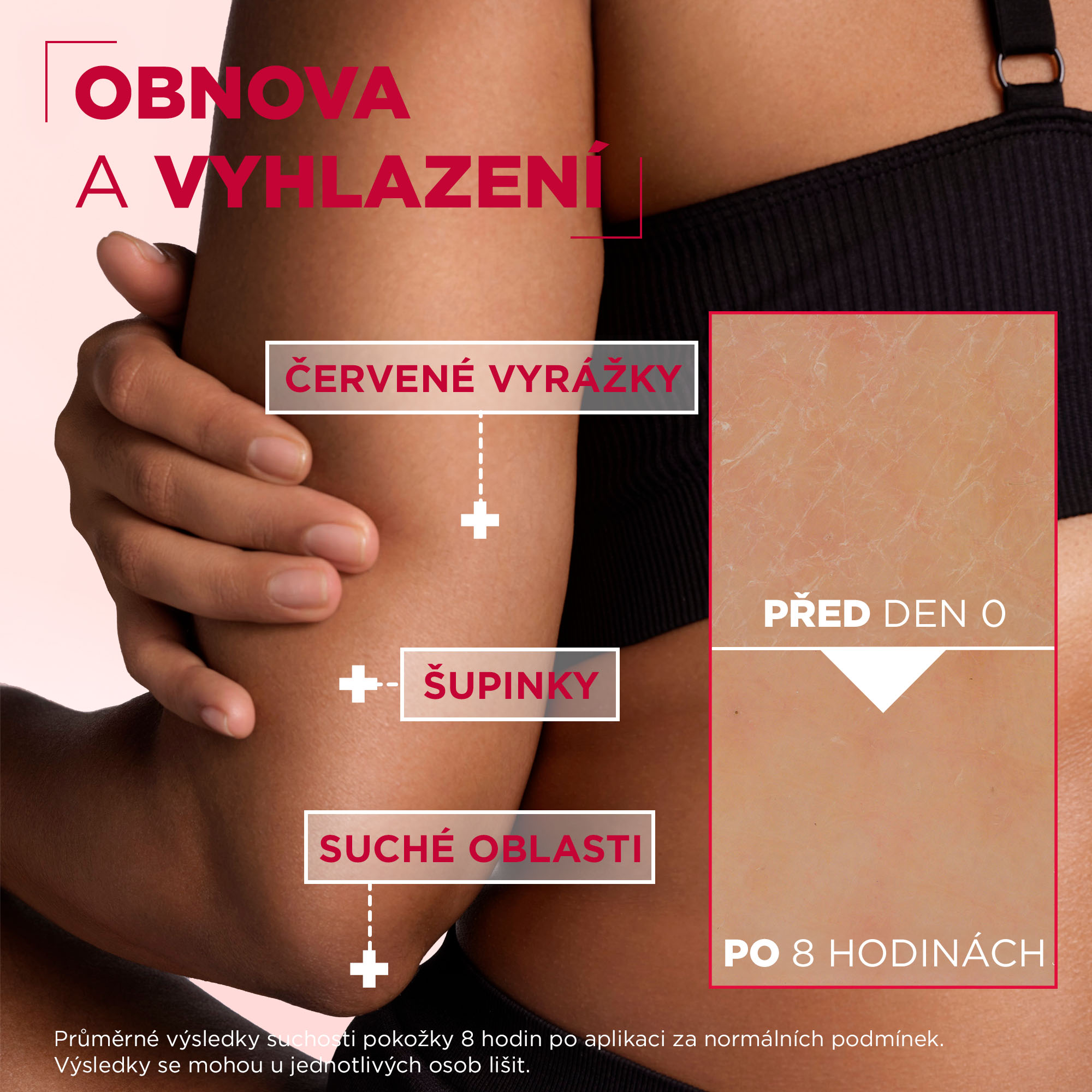 MIXA Urea Cica Repair+ 400 ml testápoló krém