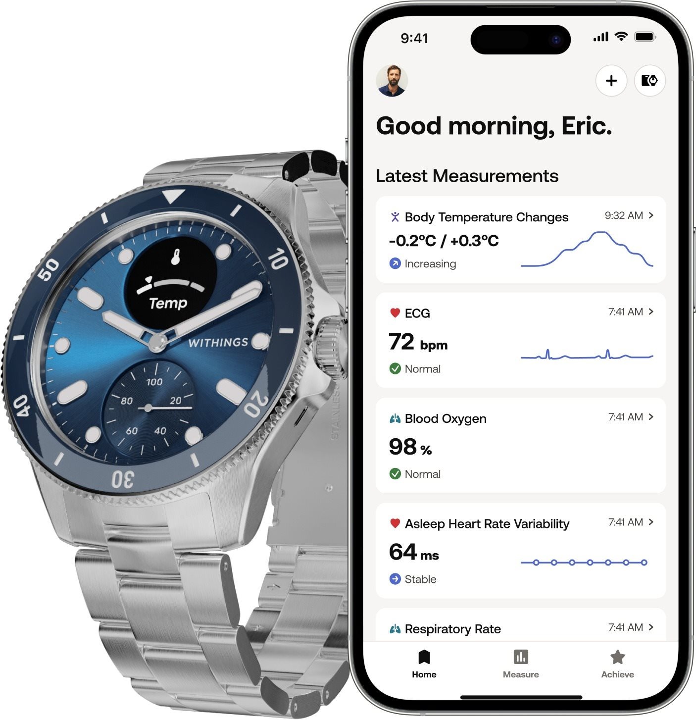 Withings Scanwatch Nova okosóra