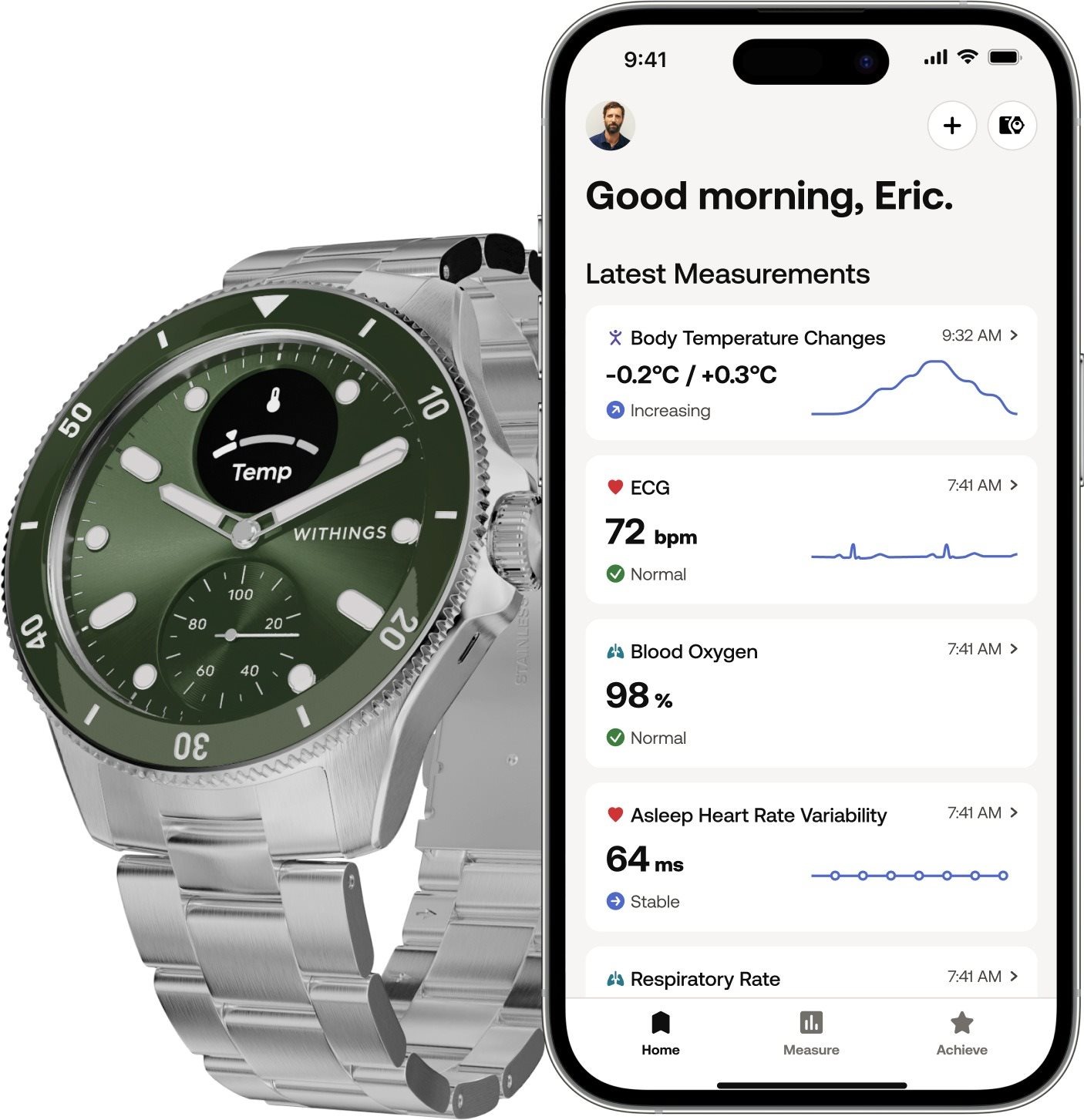 Withings Scanwatch Nova okosóra