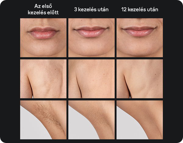 Braun IPL Silk·expert Mini PL1100 IPL szőrtelenítő