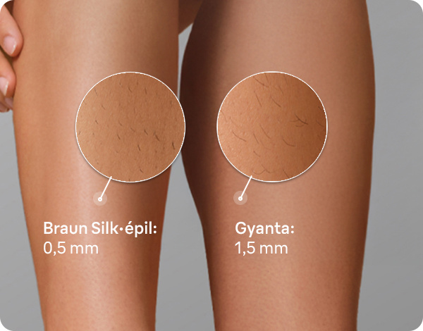Braun Silk·épil 7 7-030 epilátor