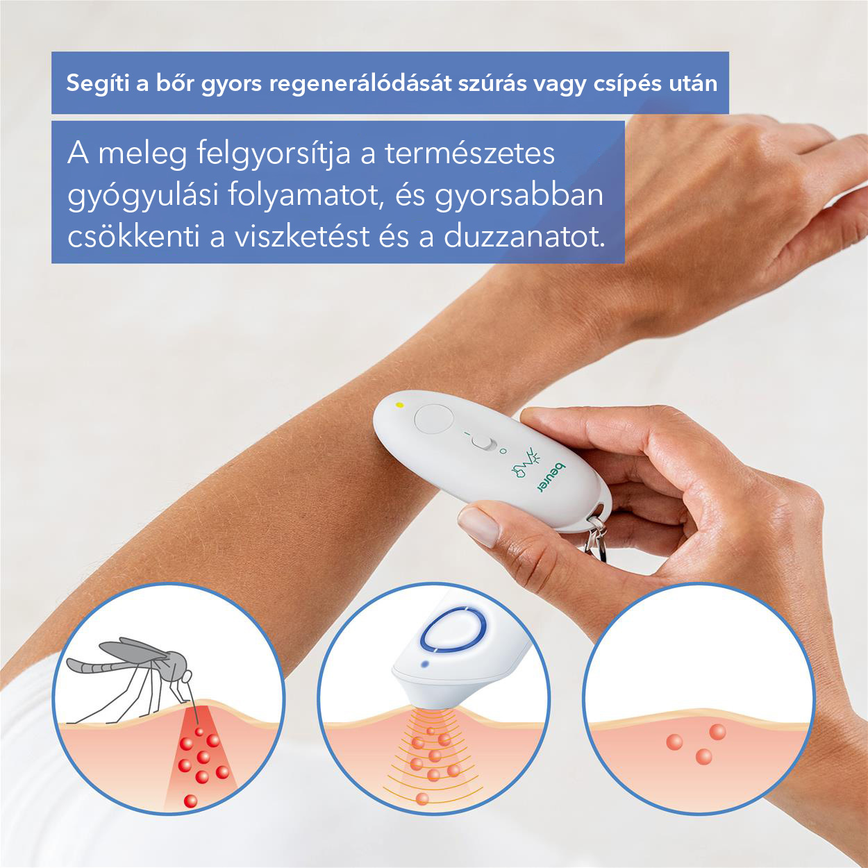 Rovarcsípés utáni készülék BEURER BR 60