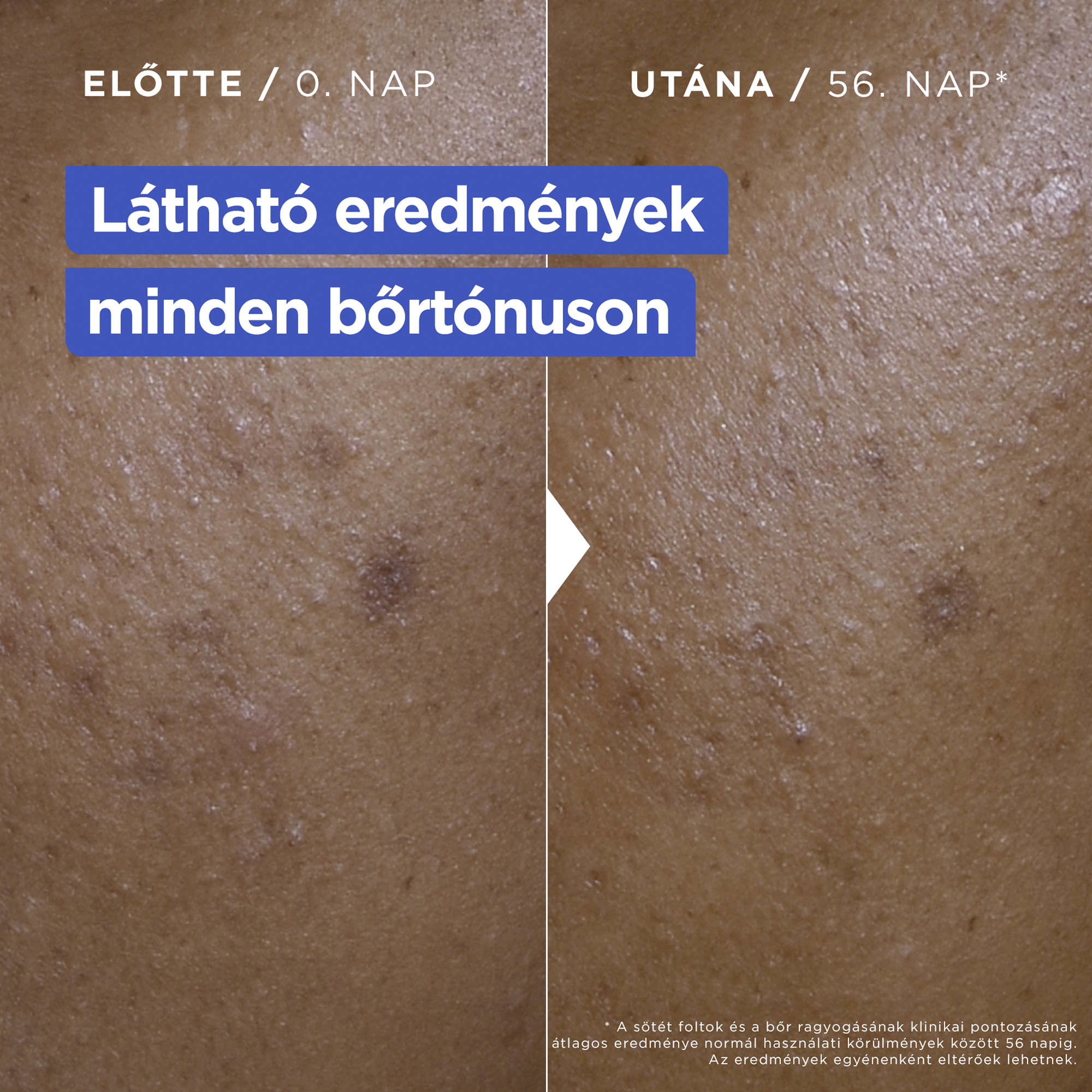 MIXA Niacinamide Bright 250 ml testápoló