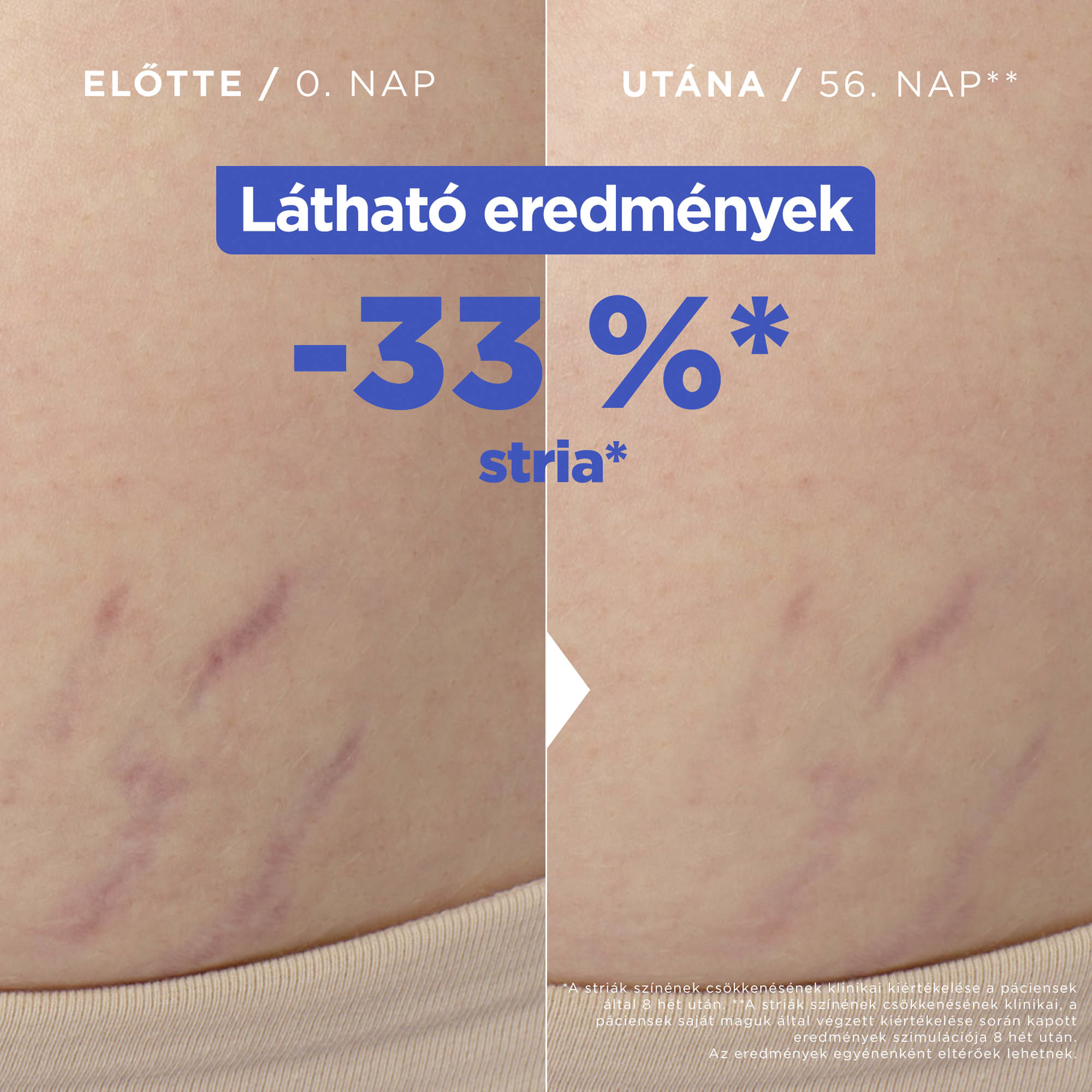 MIXA Niacinamide Bright 250 ml testápoló