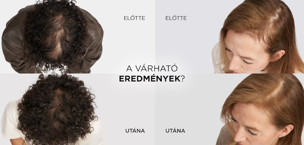 Elseve Growth Booster