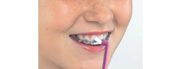 Hogyan használható az egycsomós fogkefe? 