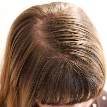 Milyen sampont vegyek?