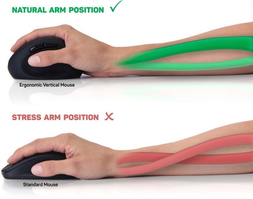 Kéztőalagút-szindróma – hogyan előzheted meg