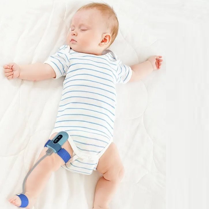 Wellue Baby Monitor légzésfigyelő