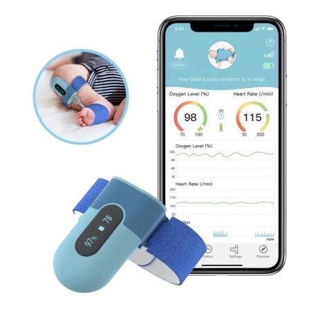 Wellue Baby Monitor légzésfigyelő