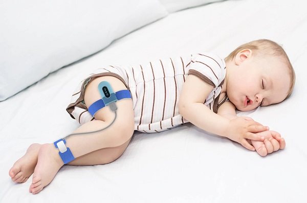 Wellue Baby Monitor légzésfigyelő
