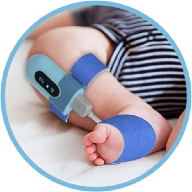 Wellue Baby Monitor légzésfigyelő
