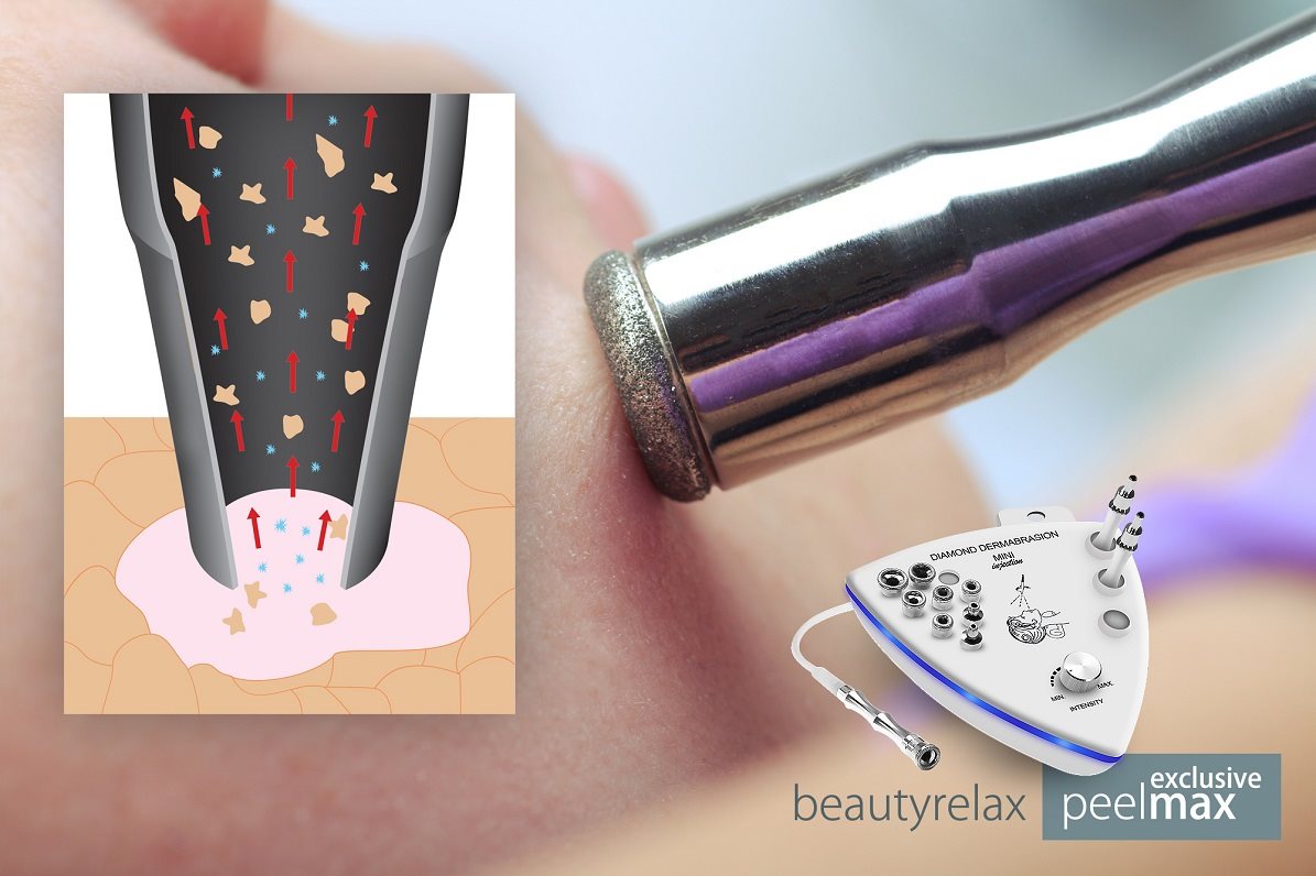 BeautyRelax Peelmax Exclusive vákuumos bőrtisztító