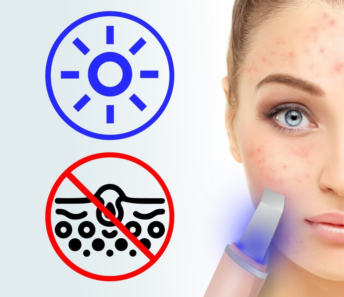 Beautyrelax Peel&lift Ultrahangos kozmetikai spatula