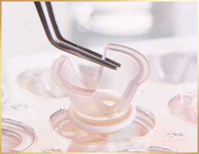 Loreal Paris Átláthatóság és bizalom